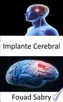 Libro Implante Cerebral