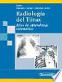 Radiología del Tórax