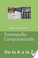Libro Tomografía Computarizada: de la A A La Z